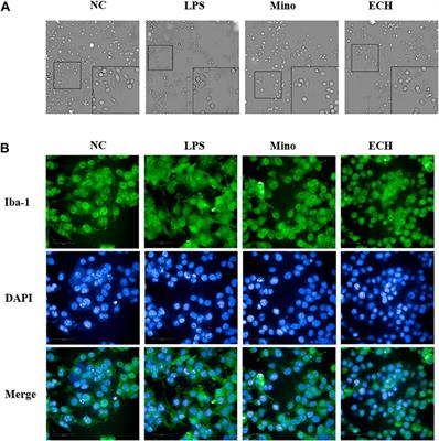 Echinacoside exerts antidepressant-like effects through enhancing BDNF-CREB pathway and inhibiting neuroinflammation via regulating microglia M1/M2 polarization and JAK1/STAT3 pathway